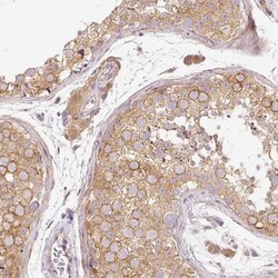 RNF167 Antibody, Novus Biologicals 25 &mu;L, Unlabeled:Antibodies, Polyclonal